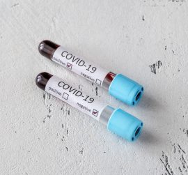 coronavirus-testing-ET8N9RX