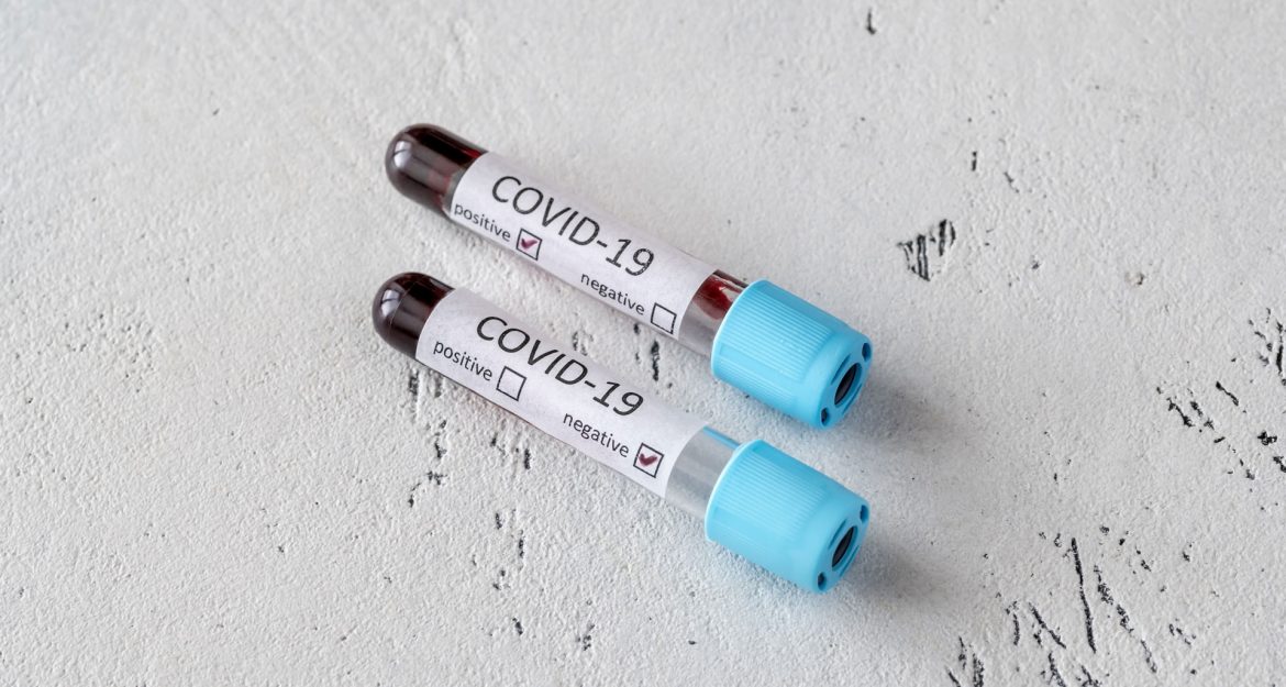 coronavirus-testing-ET8N9RX
